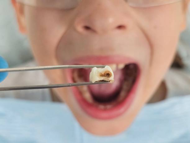 Best Emergency Dental Services Near Me  in Ampere North, NJ